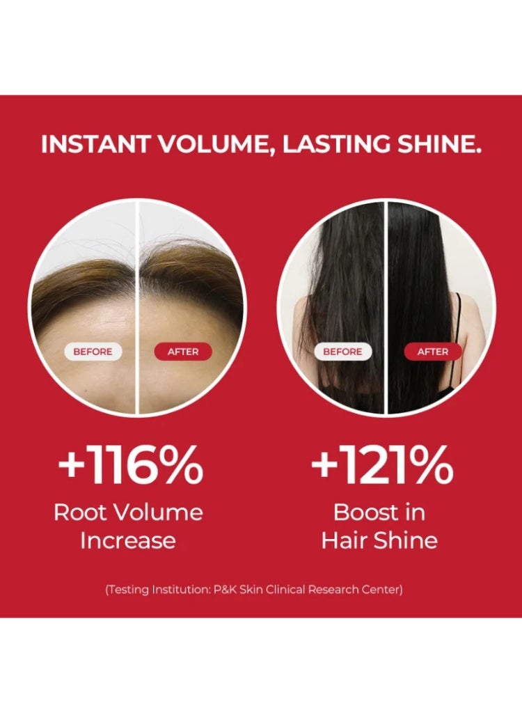 MOEV Hair Loss & Weak Hair Solution – MOEV Annurcatin Shampoo 525ml for Strengthening, Regrowth Support & Anti-Breakage Care - Image 5