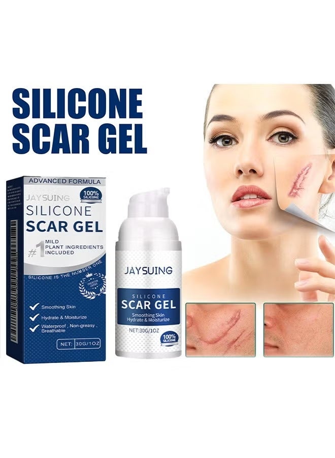 Jaysuing Silicone Scar Gel 30g Scar Cream,Scar Removal,Scar Treatment, Scar Removal Cream for C-Section, Stretch Marks, Acne, Surgery, Effective for Both Old and New Scars - Image 1