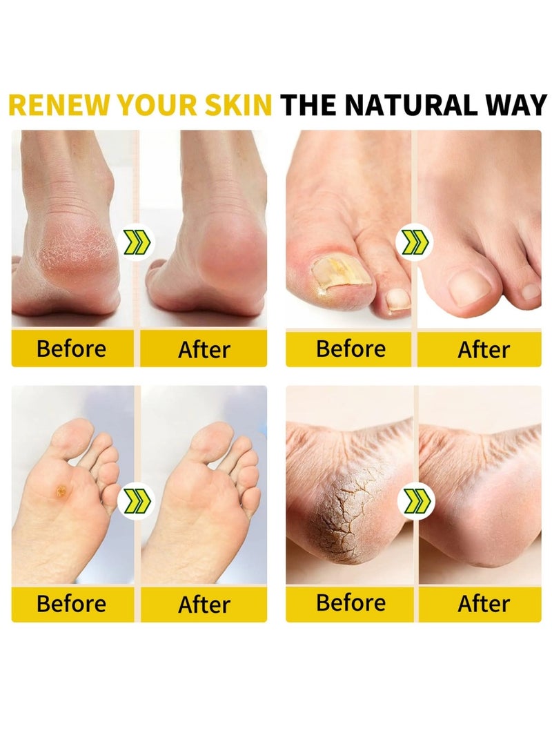 Herbal Body Soothing and Shaping Foot Soak Detox Foot Soak Beads Detox and Shaping Cleansing Foot Soak Daily Rebody Detoxing herbs Foot Soak Salt Quality Sleep Lose Weight Body Shape 10Pcs