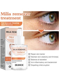 Milia Removal Treatment, Milia Spot Treatment Helps Dissolve And Reduce Milia, Whitehead And Sebaceous Hyperplasia, Cysts And Sebaceous Hyperplasia Face Serum 30 ML - pzsku/Z7B3467EE0BA65F752739Z/45/_/1705981625/daab9c8d-cc4f-4fe6-96ad-621442d71e00