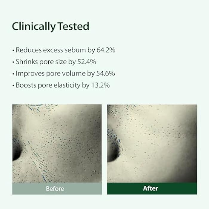 BLITHE Targeted Pore Serum with 22% Niacinamide for Oil Control, Pore Minimizer for Face, Korean Skin Care, K-Beauty Gift & Stocking Stuffer Idea – 1 fl oz - Image 4