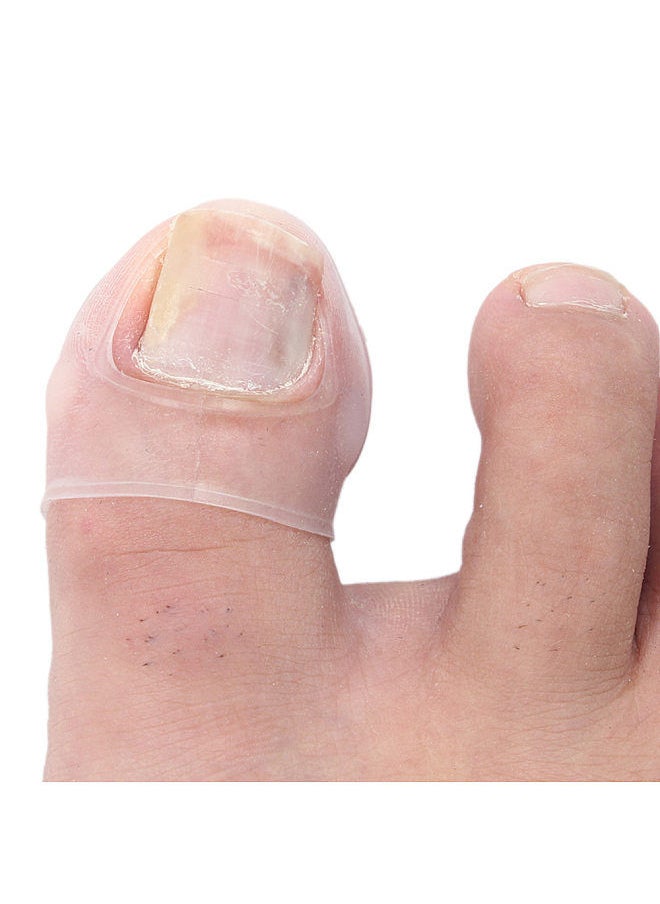 Generic - 2PCS Ingrown Toenail Correction Tool Toe Cap Toenail Protector Big Toe Sleeves Thick Paronychia Correction Tool - Image 1