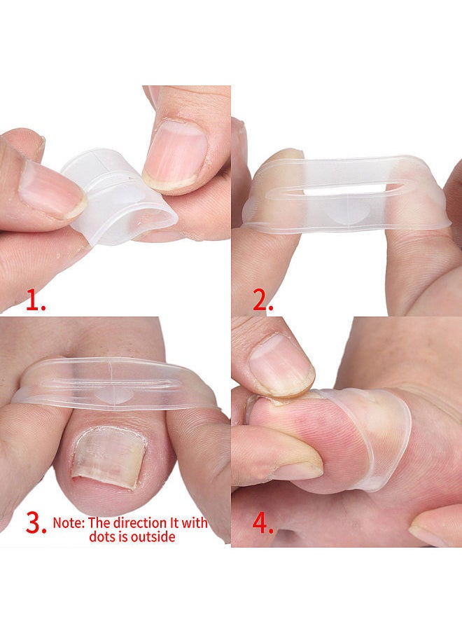Generic - 2PCS Ingrown Toenail Correction Tool Toe Cap Toenail Protector Big Toe Sleeves Thick Paronychia Correction Tool - Image 1