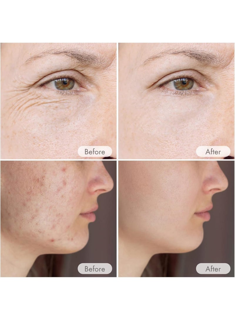 SOLARAE قلم ميكرونيدلنج لاسلكي احترافي، قلم ميكرونيدلنج سيروم تلقائي لاسلكي مع 12 رأس خرطوشة، 6 مستويات سرعة قابلة للتعديل من 0-1.0 مم، مجموعة احترافية لجمال المنزل - Image 2