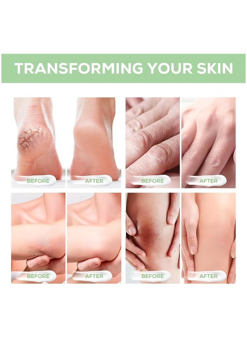 ATRJSZ Urea Cream 40% with Salicylic Acid 2%, Foot Cream for Dry, Cracked, Thick, and Rough Skin, Deeply Moisturizing, Gently Exfoliating Dead Skin and Flakes 4.23oz - Image 5