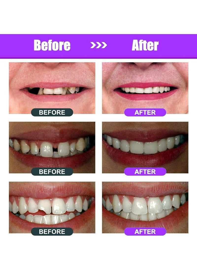 CMGTYYD - DIY Tooth Filling Repair Kit for Missing and Broken Teeth – Easy Home Solution to Regain Your Confident Smile - Image 1