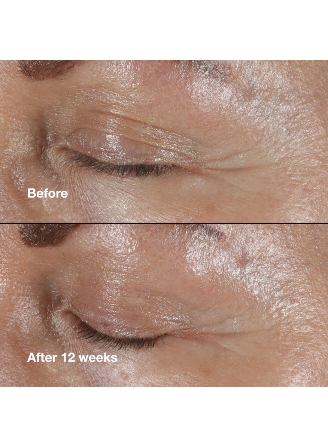 Clinique Smart Clinical Repair Wrinkle Correcting Eye Cream 15ml. - Image 3