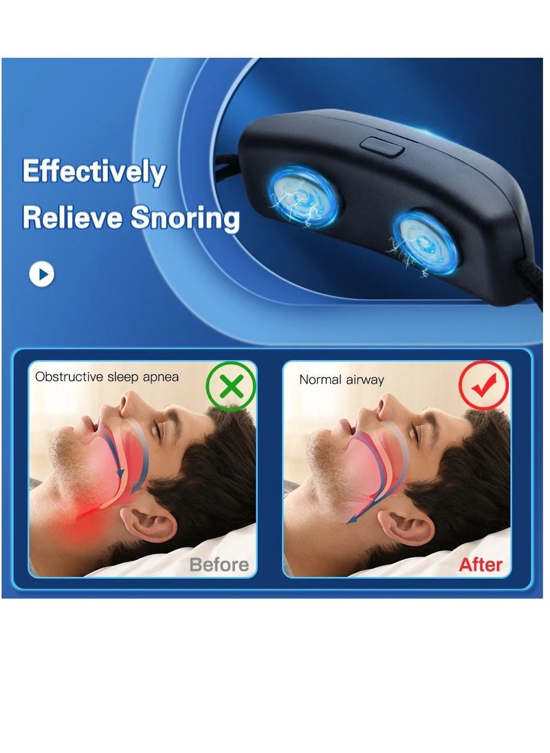 ماركة غير محددة - جهاز SleepPro Smart EMS لمكافحة الشخير ، جهاز EMS ذكي لمكافحة الشخير ، جهاز SleepRex الذكي لمكافحة الشخير ، جهاز EMS ذكي لمكافحة الشخير للنوم المريح (قطعة واحدة وسماعات أذن) - Image 1