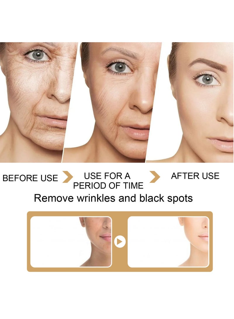 EELHOE Turmeric Dark Spot Corrector Serum, Anti Aging Turmeric Repair Face Serum, Smooth And Gentle Moisturizing Facial Serum For Acne, Dark Spots, Hyperpigmentation, Smooth Skin, (30ml, 1pc)  - Image 2
