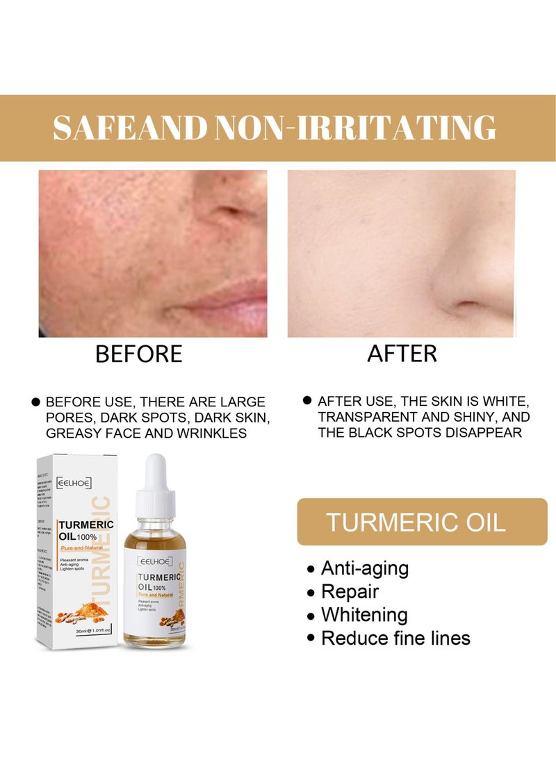 EELHOE Turmeric Dark Spot Corrector Serum, Anti Aging Turmeric Repair Face Serum, Smooth And Gentle Moisturizing Facial Serum For Acne, Dark Spots, Hyperpigmentation, Smooth Skin, (30ml, 1pc)  - Image 4