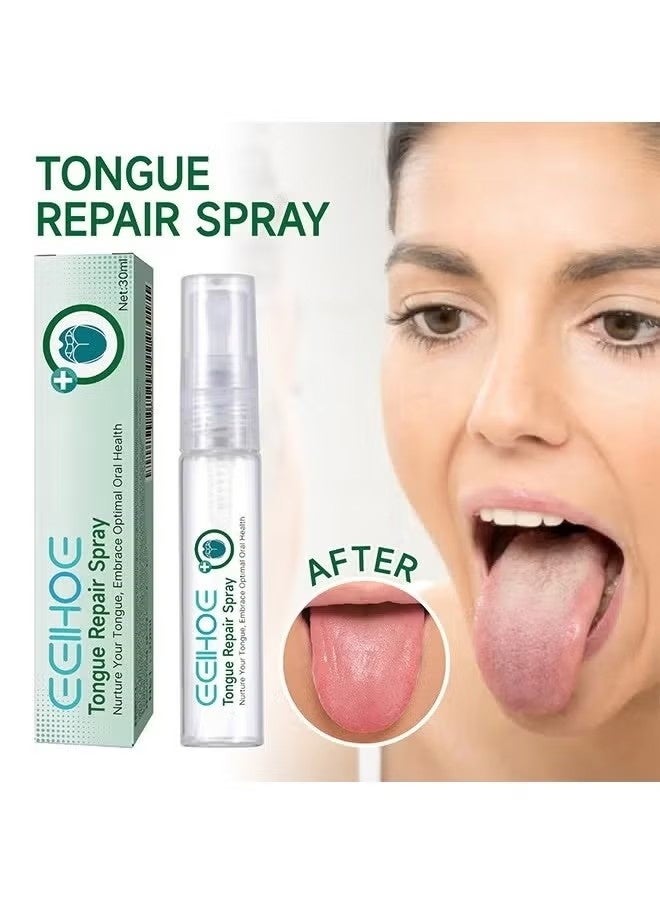 EELHOE Tongue Repair Spray,Mouth Repair Spray Repairs White Tongue Coating, Tongue Care Spray, Portable Mouth Spray, Mouthwash Spray, Freshens Breath, Eliminates Bad Breath 30ml - Image 1
