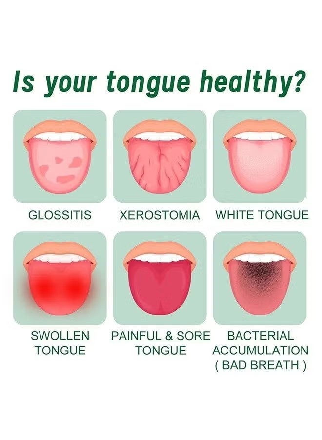 EELHOE Tongue Repair Spray,Mouth Repair Spray Repairs White Tongue Coating, Tongue Care Spray, Portable Mouth Spray, Mouthwash Spray, Freshens Breath, Eliminates Bad Breath 30ml - Image 4