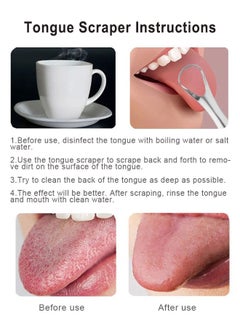 Super ZYouth 4-Piece Tongue Scraper Set Tongue Cleaner for Oral Cleaning Reduce Bad Breath and Fresh Breath with Stainless Steel Box  - Image 4