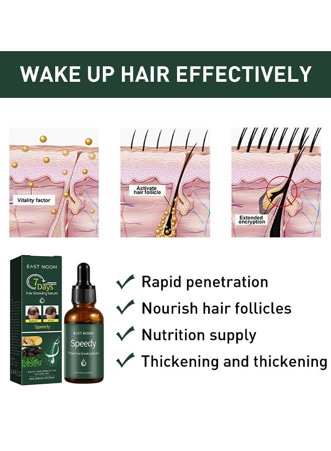 إيست مون مصل نمو الشعر لمدة 7 أيام 30 مل ، علاج الشعر بالنمو السريع بالزنجبيل ، خلاصة إعادة نمو الشعر المضادة لتساقط الشعر ، زيت أساسي مغذي للعناية بالشعر - Image 3