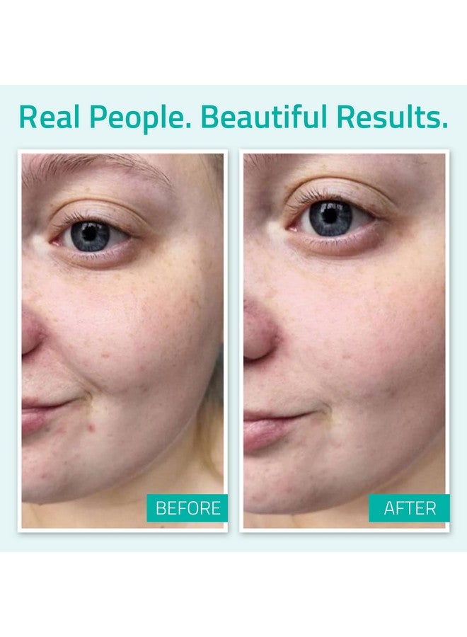 YEOUTH Pure Hyaluronic Acid Serum for Face 100%, Hydrating Serum for Dry & Dull Skin, Moisturizing Serum, Hyaluronic Serum for Face, Women & Men Face Serum 2oz - Image 4