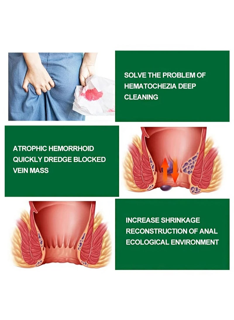 HBESTY 30ml Herbal Hemorrhoids Spray, Natural Herbal Formula, Treats Hemorrhoids, Quickly Reduces Swelling And Stops Bleeding (2PCS)  - Image 5