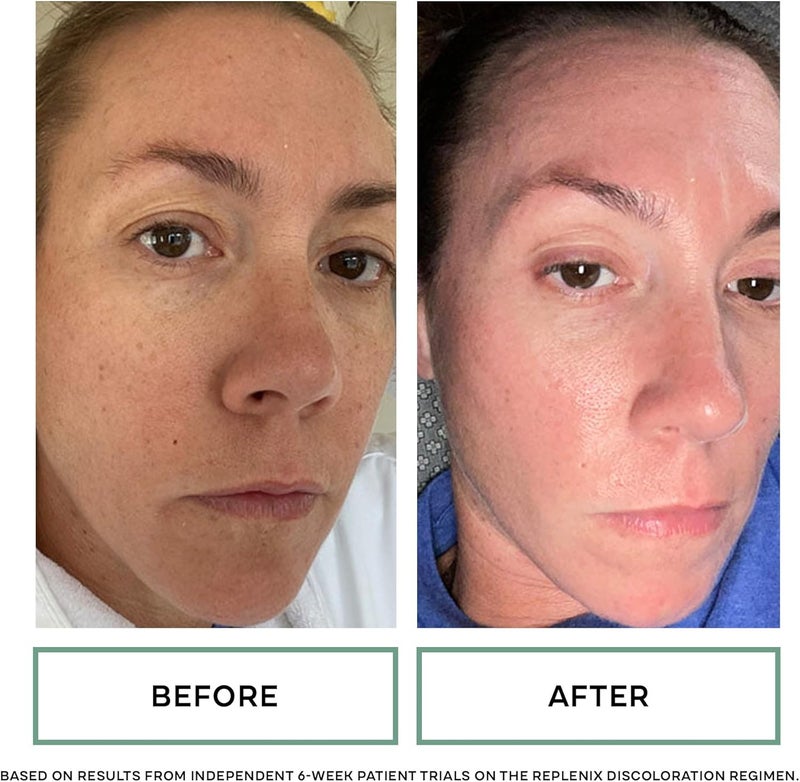 Replenix Glycolic Acid 10% Resurfacing Skin Peel - Medical-Grade Facial Peeling Pads for Discoloration & Acne (60 ct.) - Image 5