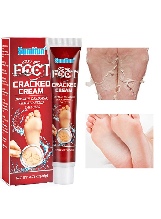 Sumifun Foot Cracked Cream, Anti-Cracking Moisturizing Foot And Hand Cream Beauty, Intensive Foot Repair Cream, Skin Healing Ointment For Dry Skin, Dead Skin, Cracked Heels, Calluses  20G - Image 1