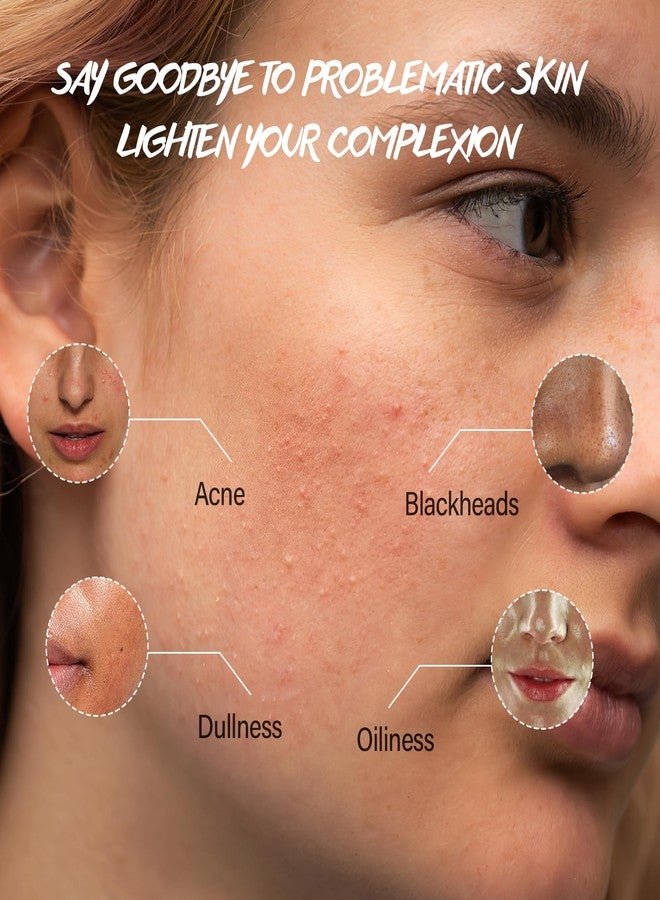 POP MODERN.C Turmeric Exfoliating Face Wash Vitamin C Facial Cleanser Microdermabrasion Exfoliator Face Scrub Foaming Cleanser Removing Blackhead Acne Moisturizing Soft Natural Skin Care for Women Men - Image 4