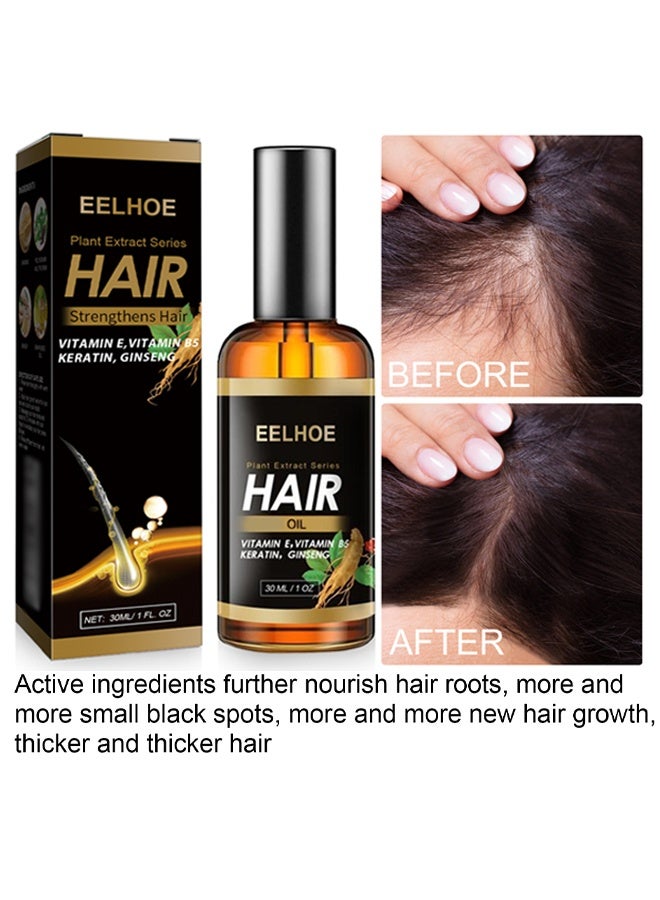 إيلهو زيت نمو الشعر من سلسلة المستخلص النباتي ، زيت الزنجبيل العطري لنمو الشعر ، لتساقط الشعر ، ينمو الشعر بشكل أكثر كثافة وأطول ، ونمو الشعر بسرعة - Image 2