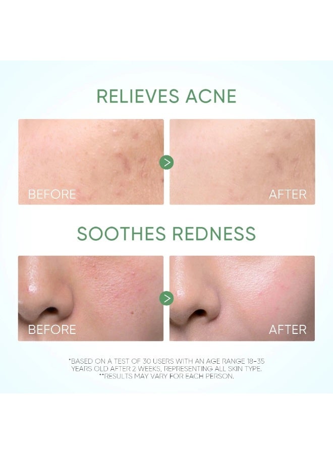 SKINTIFIC Skintific Pure Centella Acne Calming Toner Controls Oil For Redness Itchiness Acne Skin (80ml)  - Image 5