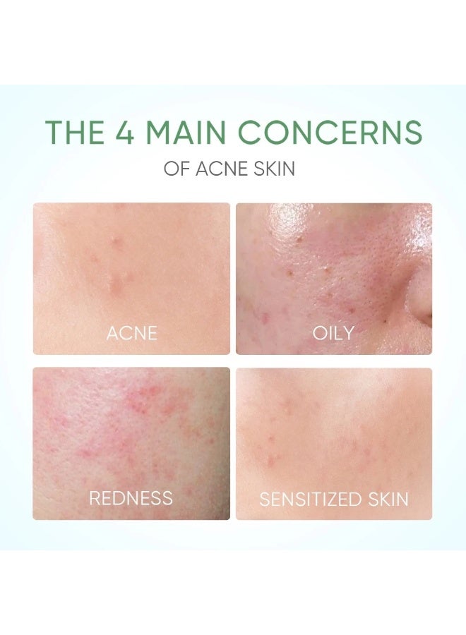 SKINTIFIC Skintific Pure Centella Acne Calming Toner Controls Oil For Redness Itchiness Acne Skin (80ml)  - Image 2