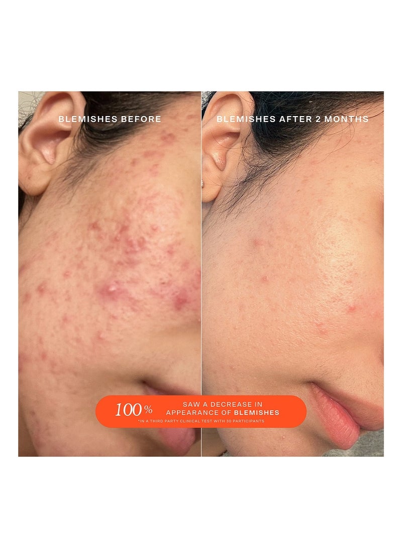 TOWER 28 Spray for the care of irritated and damaged skin_ 4 fl oz 120ml - Image 3