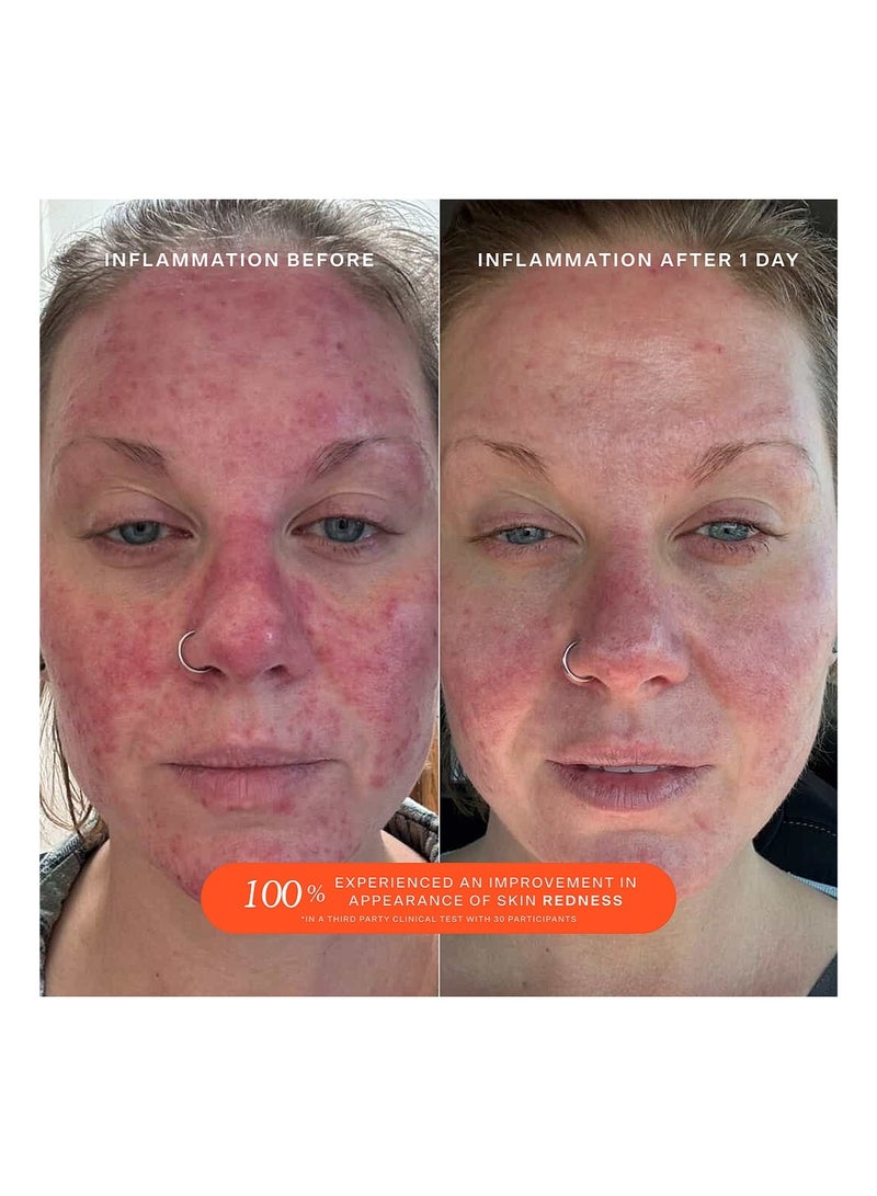 TOWER 28 Spray for the care of irritated and damaged skin_ 4 fl oz 120ml - Image 4