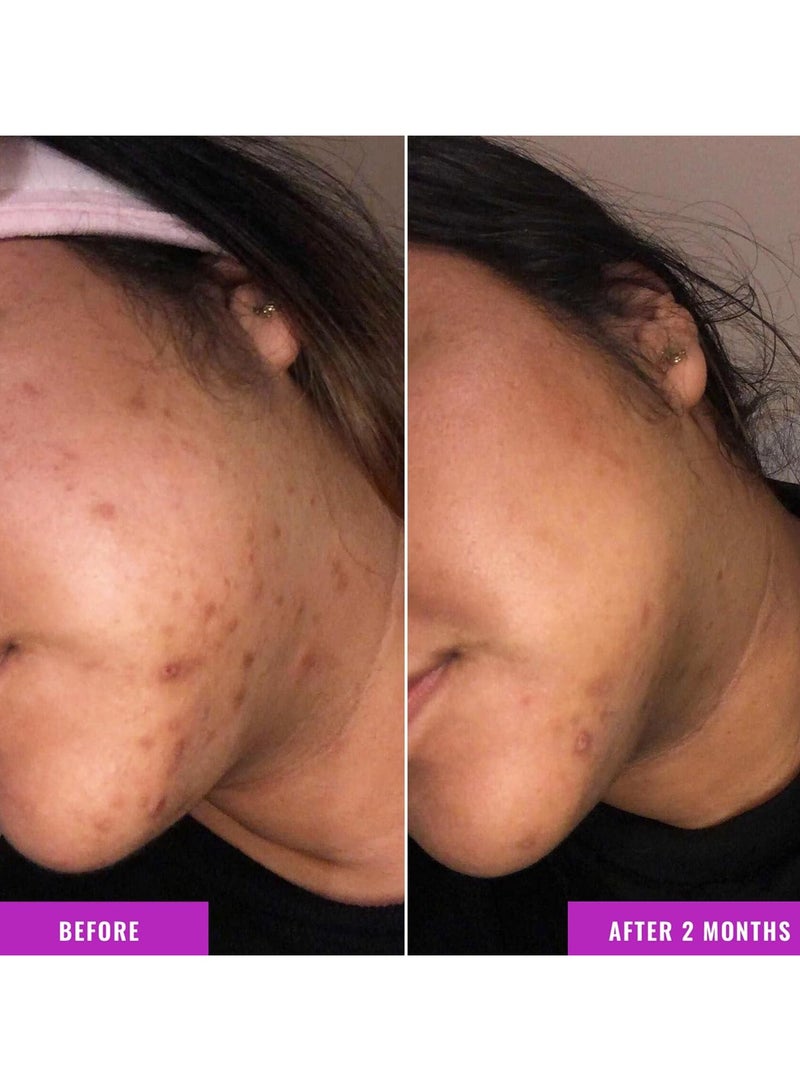 Good Molecules Good Molecules Discoloration Correcting Serum - Tranexamic Acid Ester Salt and Niacinamide for Dark Spots, Sun Damage, and Age Spots - Skincare Face  - Image 3
