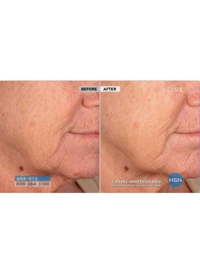 nassif md Hydroscreen Face And Body Souffle Hydrating Skin Moisturizer Hyaluronic Acid Omega 3 Anti Aging Even Skin Tone 4 Fl Oz - Image 5