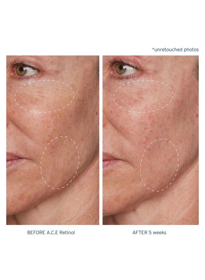 Santo Remedio Piel Eterna A.C.E. Retinol Intensive Rejuvenation Oil 1 Fl Oz With Retinol Oil 2.5% Vitamins C & E And Squalane - Image 5