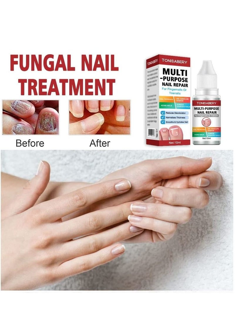 TONISABERY - Fungal Nail Renew & Repair Essence Serum Kill Nail Fungus Nourish Nails Regenerate Damaged Finger & Toe Nail Revive Nail Discolorations 10ml - Image 1