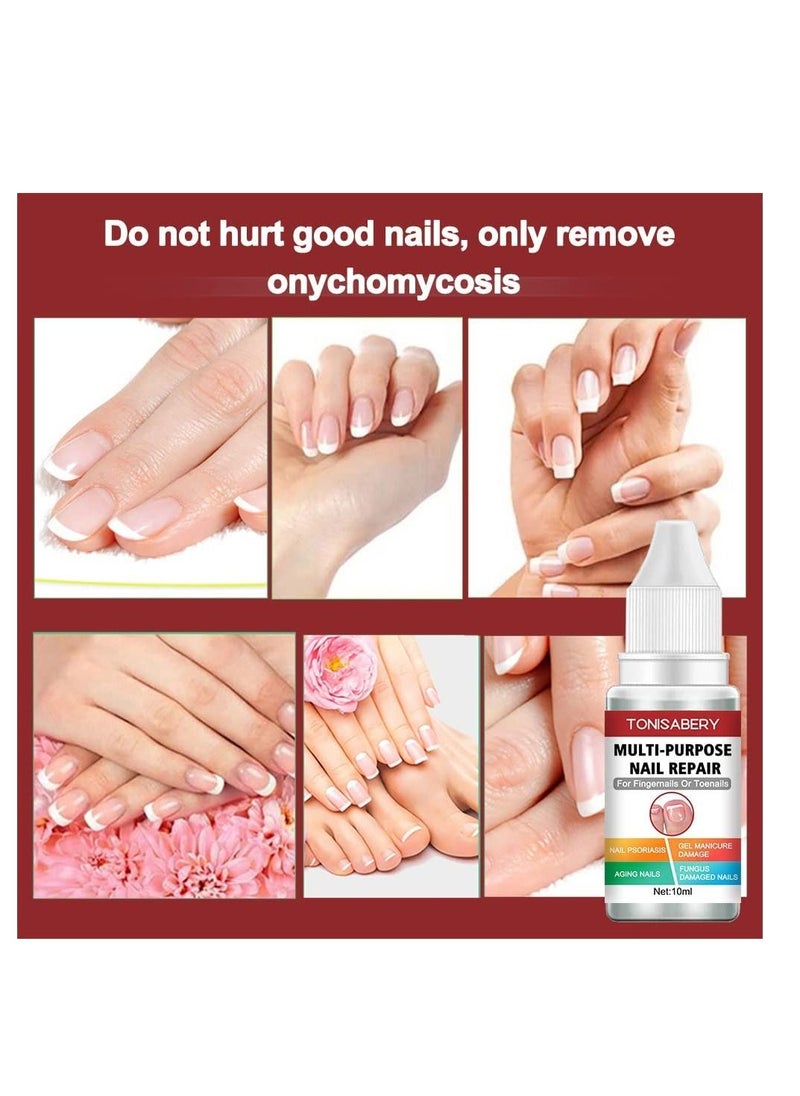 TONISABERY - Fungal Nail Renew & Repair Essence Serum Kill Nail Fungus Nourish Nails Regenerate Damaged Finger & Toe Nail Revive Nail Discolorations 10ml - Image 1