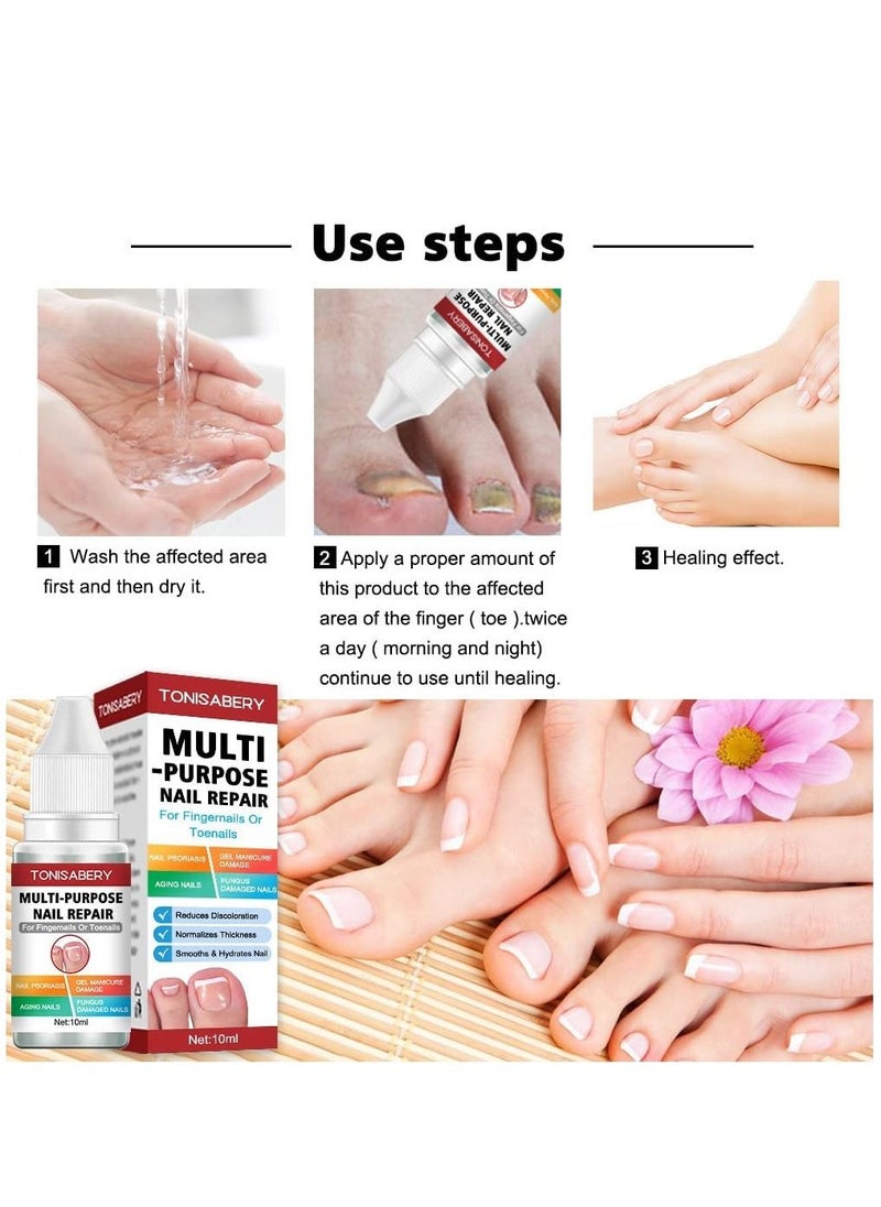 TONISABERY - Fungal Nail Renew & Repair Essence Serum Kill Nail Fungus Nourish Nails Regenerate Damaged Finger & Toe Nail Revive Nail Discolorations 10ml - Image 1