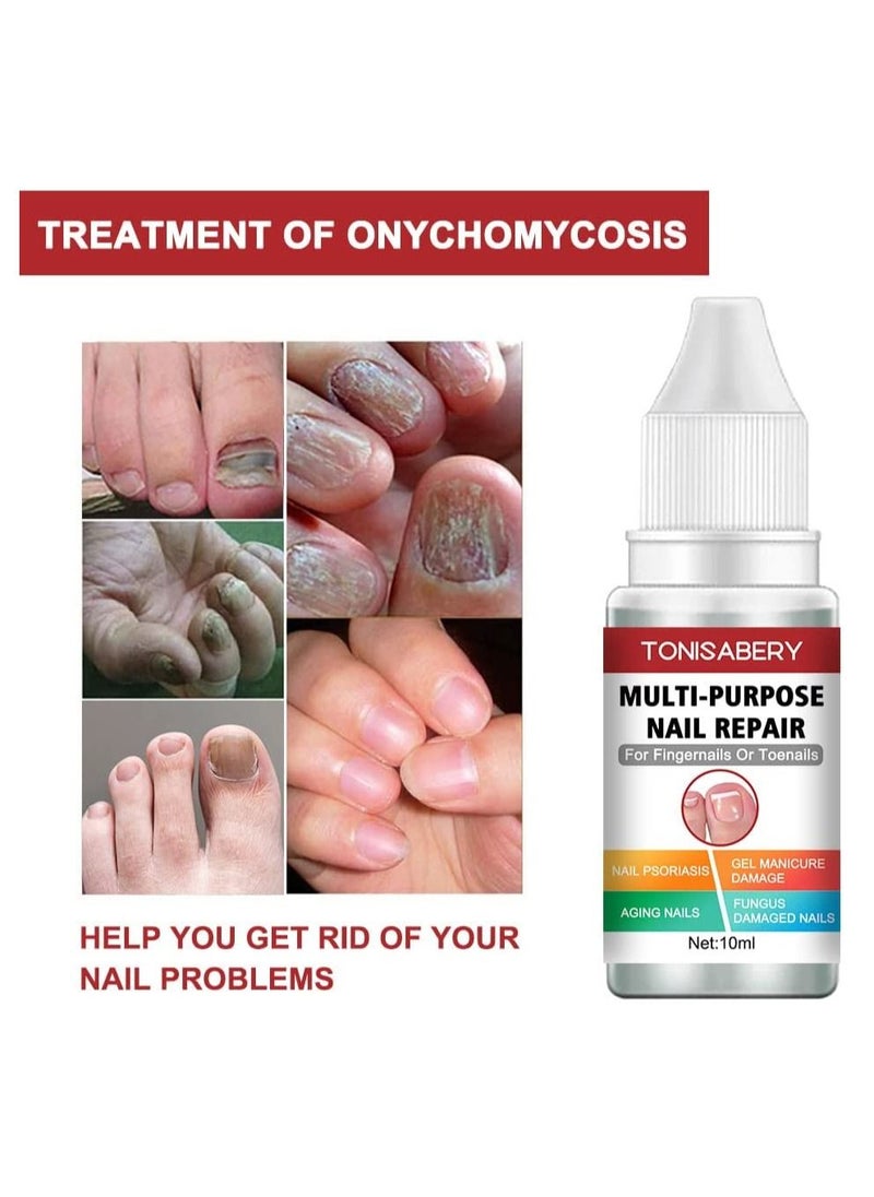 TONISABERY - Fungal Nail Renew & Repair Essence Serum Kill Nail Fungus Nourish Nails Regenerate Damaged Finger & Toe Nail Revive Nail Discolorations 10ml - Image 1