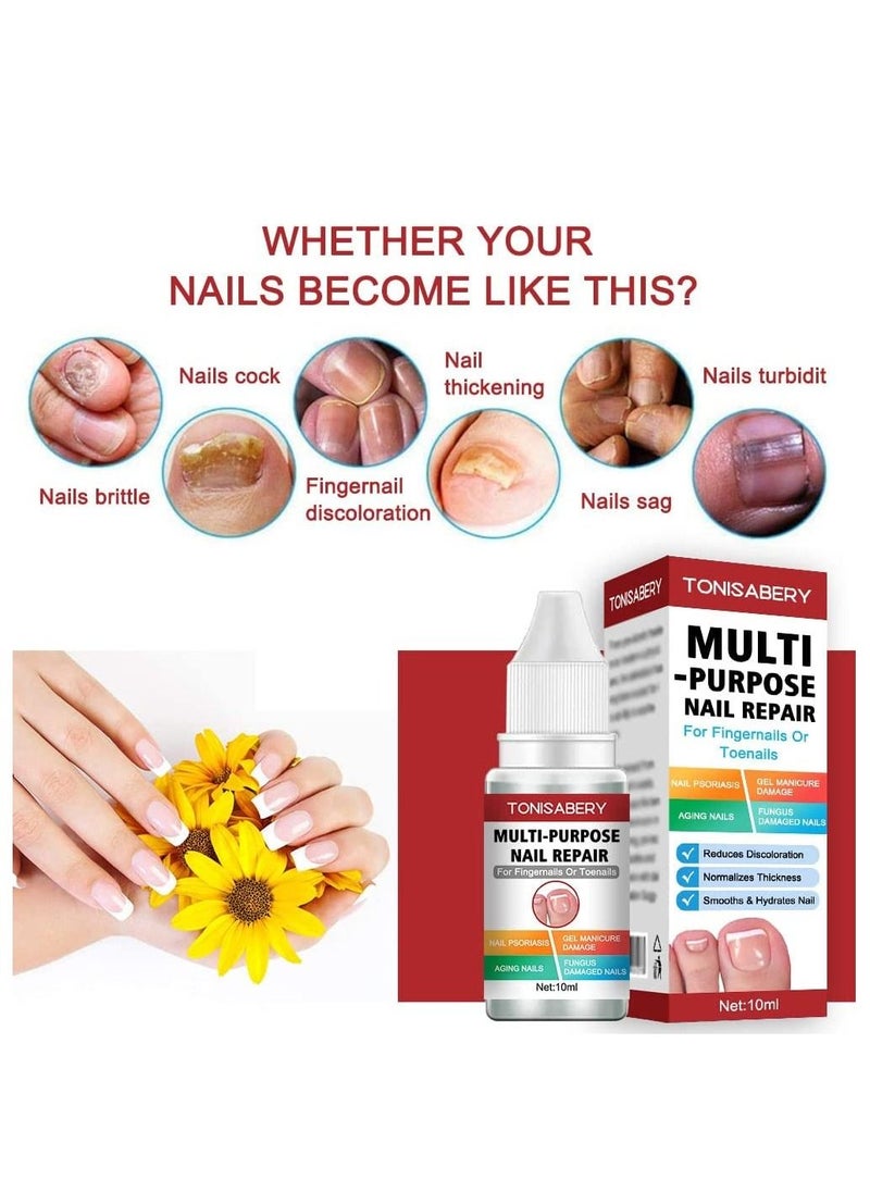 TONISABERY - Fungal Nail Renew & Repair Essence Serum Kill Nail Fungus Nourish Nails Regenerate Damaged Finger & Toe Nail Revive Nail Discolorations 10ml - Image 1