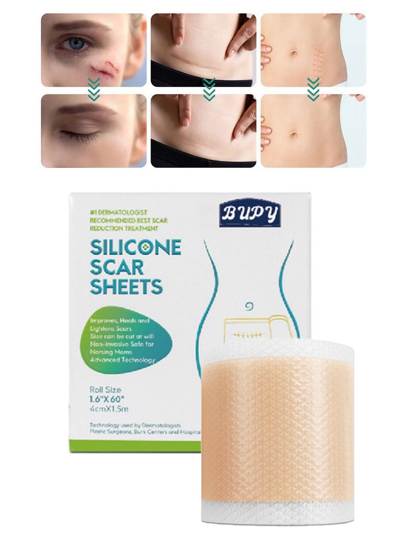 BUPY Silicone Scar Sheets,Effective Safe Breathable Comfortable Long-Lasting Results Scar Care Adopt Advanced Technology to Improve Heal and Lighten Scars for Old and New Scars 4cm*1.5m - Image 1