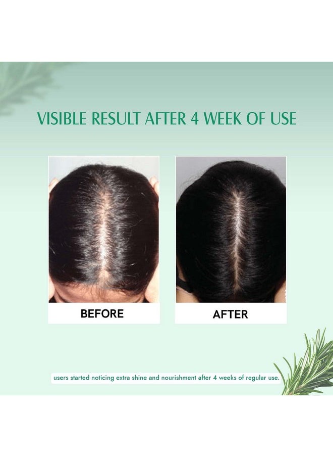 Aravi Organic Rosemary Oil And Hair Growth Serum Combo  - Image 4