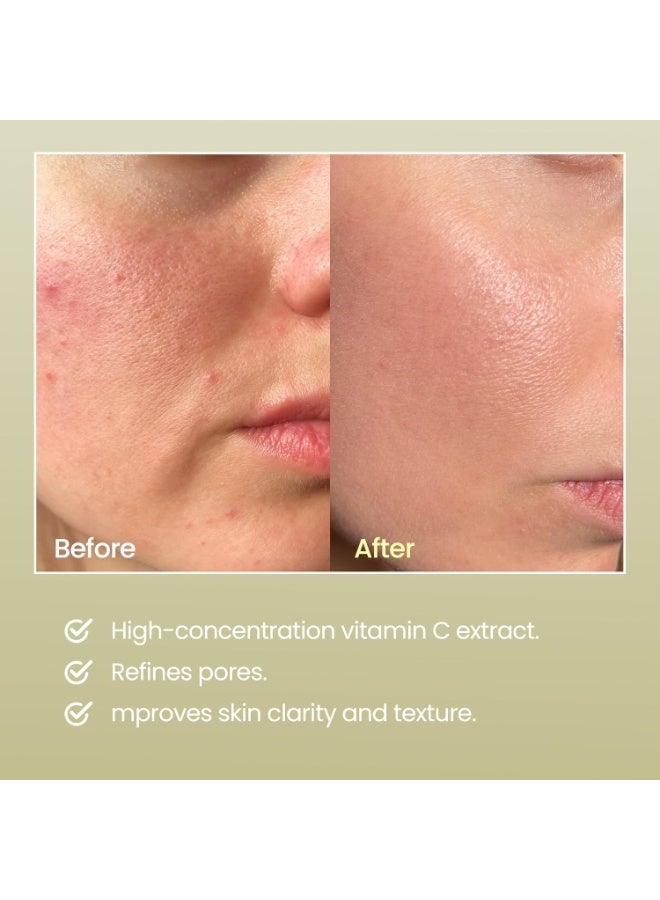 NEOGEN Dermalogy Real Vitamin C Serum 22%, 32g - Image 5