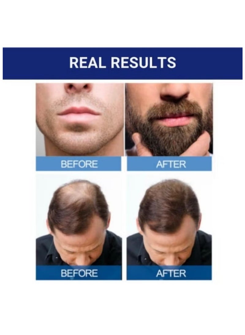 Kirkland 6 Piece Minoxidil 5% Extra Strength Hair Regrowth Treatment 360ml Powerful Solution for Thinning Hair - Image 3