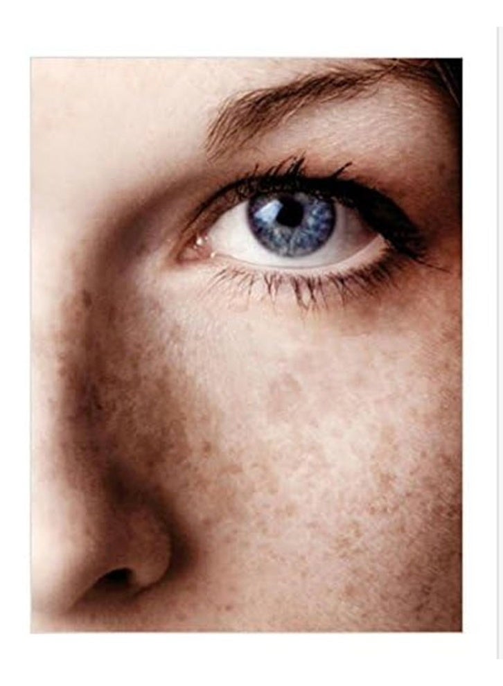 أيه سي أم كريم ايه سي ام ديبيوايت ادفانسد المكثف المضاد للبقع من فولتفاس، 40 مل، قد يختلف تصميم العبوة - Image 4