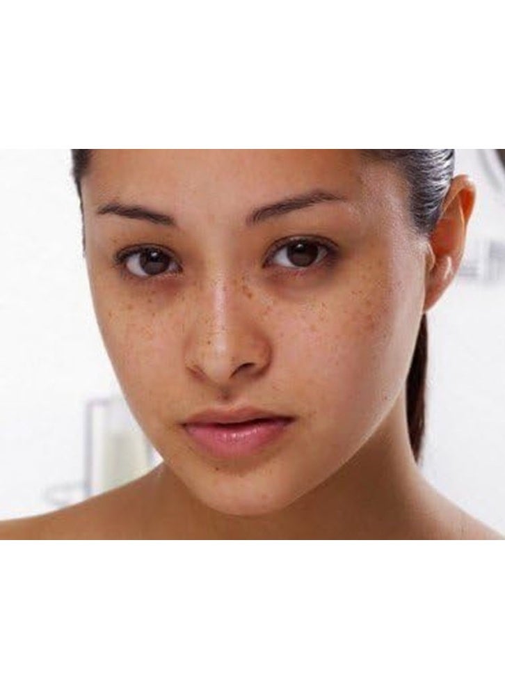 أيه سي أم كريم ايه سي ام ديبيوايت ادفانسد المكثف المضاد للبقع من فولتفاس، 40 مل، قد يختلف تصميم العبوة - Image 2