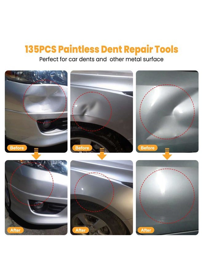 Sigoobal Car Dent Puller Kit, 135pcs Paintless Dent Removal Kit, Car Dent Repair Kit with Golden Lifter, Bridge Puller, Slide Hammer 2 in 1 T-Bar, Dent Puller for Car Refrigerator Door Ding Repair - Image 4