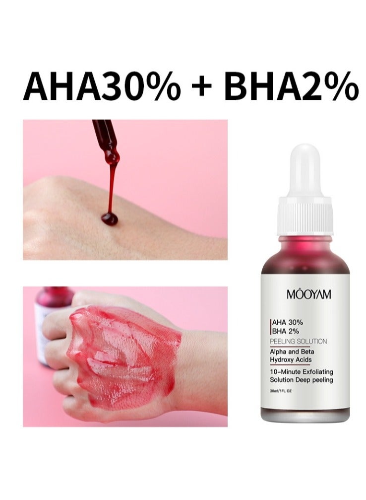 MOOYAM AHA 30% + BHA 2% Peeling Solution Exfoliating AHA 30% BHA 2% Peeling Solution Anti Acne Serum Chemical Peel for Face at Home BHA AHA Mask Red Peel BHA Liquid Exfoliant for Blemishes Wrinkle 30ml  - Image 1