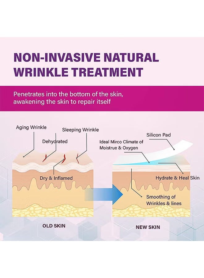 Sefudun Face Smoothing Patch 160PCS, Forehead Winkle patches, Face Smoothing Patch, Face Lift Tape Invisible, Wrinkle Patches For Face Overnight, Facial Patches To Reduce Fine Wrinkles, Frown And Smile Lines - Image 4