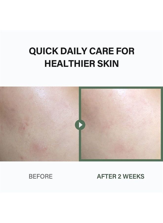 celimax celimax Ji.Woo.Gae Heartleaf BHA Peeling Pad, Smooth but Effective Facial Exfoliating Toner Pad, 60pads  - Image 3