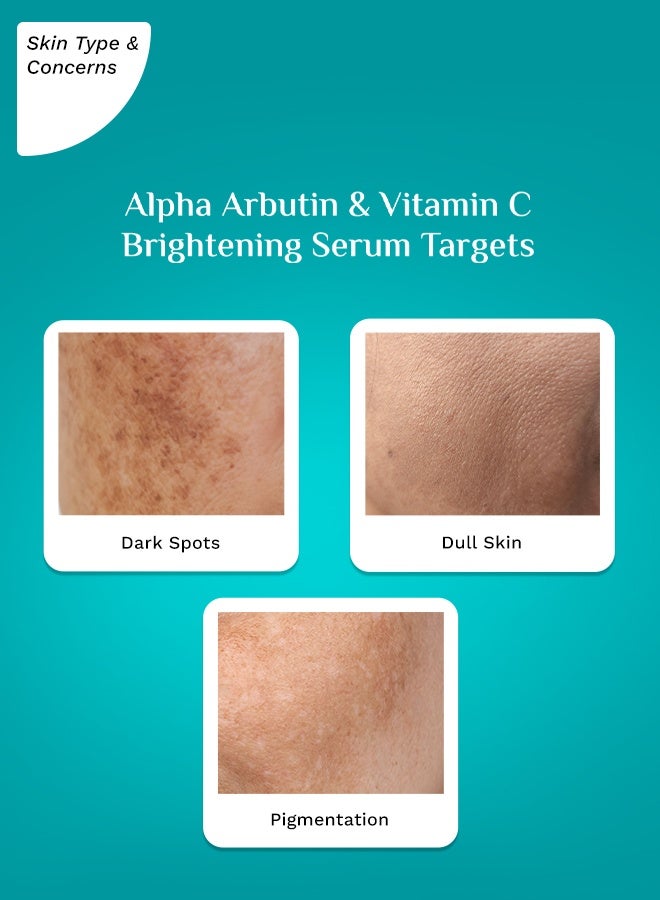 PILGRIM Korean 2% Alpha Arbutin & 3% Vitamin C Brightening Face Serum(30Ml) For Glowing Skin| Alpha Arbutin Face Serum|All Skin Types | Men & Women| Korean Skin Care| Vegan & Cruelty-Free - Image 4