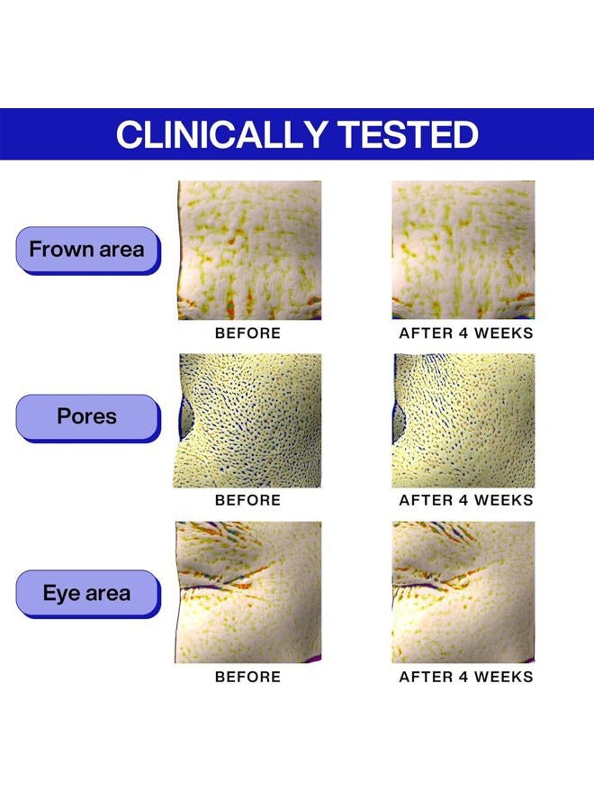 Iope Retinol Super Bounce Serum | Korean Retinoid Eye Treatment for Anti-Aging, Beginner Friendly, Reduction in Fine Lines & Wrinkles, Firming and Rejuvenating, Daily Glow Routine, 1.69 Fl Oz. (50ml) - Image 2