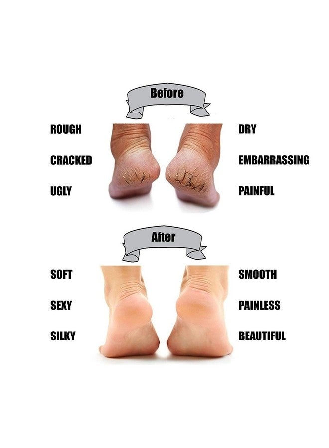 Plenteous Plenteousilicone Gel Heel Socks for Dry Hard Cracked Heel Repair Pad, Swelling & Pain Relief, Cushion Support, Foot Care, Ankle Protection, Plantar Fasciitis for Men and Women (Free Size, Skin,2 Pair) - Image 5