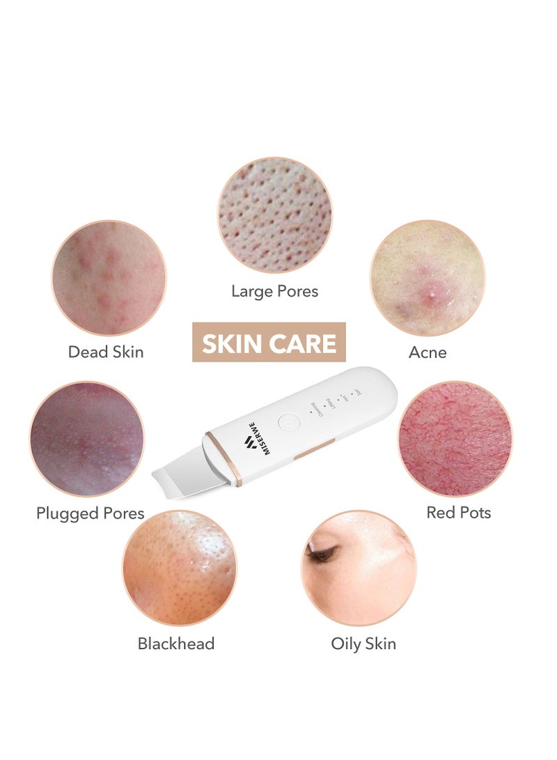 Miserwe Skin Scrubber Face Skin Spatula Facial Scrubber Spatula for Deep Cleansing Blackhead Remover Pore Cleaner with 4 Modes (White) - Image 2